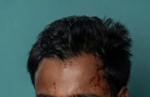 भंडारें में धारदार हथियार से किया हमला ,युवक घायल
